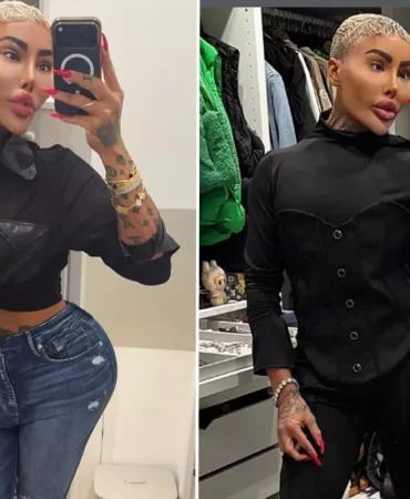 Kim Kardashian'a benzemek için estetik yaptıran fenomen hayatını kaybetti: 2 kişi cinayetten tutuklandı