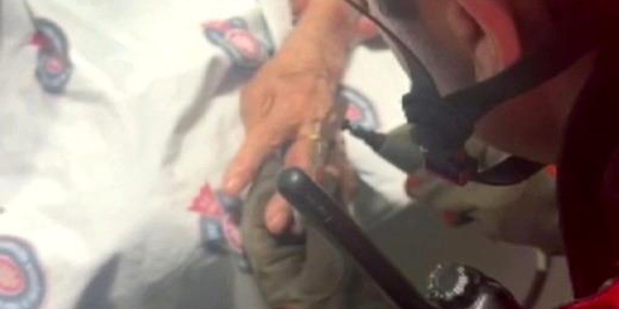 Kahramanmaraş'ta Yüzük Sıkıştı, İtfaiye Kurtardı