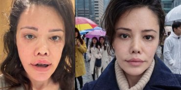 “Kore’de yüz nakli oldum” demişti… Didem Ceran: Bebeksiliğim yapay zeka değil